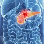 Tumore al pancreas, la diagnosi migliorata grazie ad un 15enne!